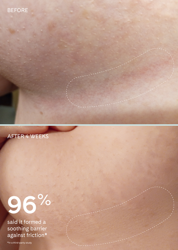 Chafe Cushion