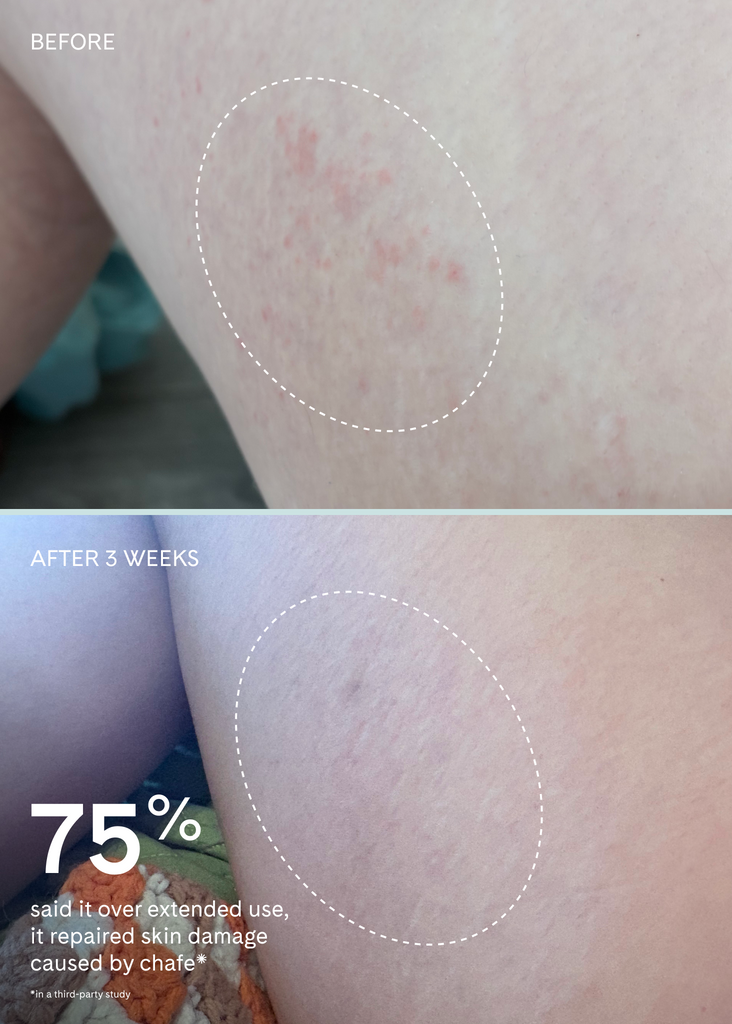 Chafe Infected Chafe Stick | FUR Chafe Cushion – Fur