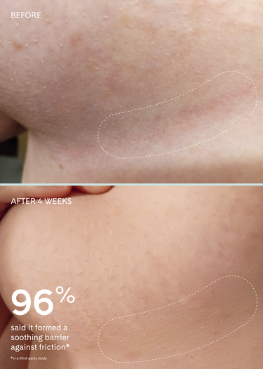 Chafe Cushion