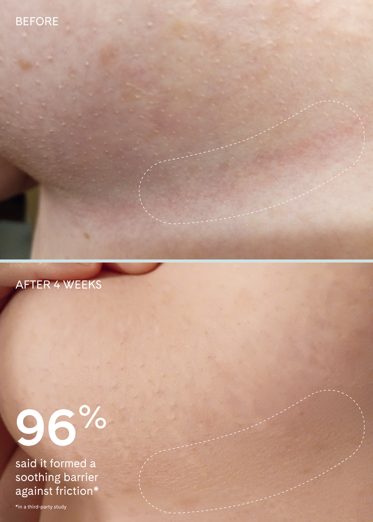 Chafe Cushion