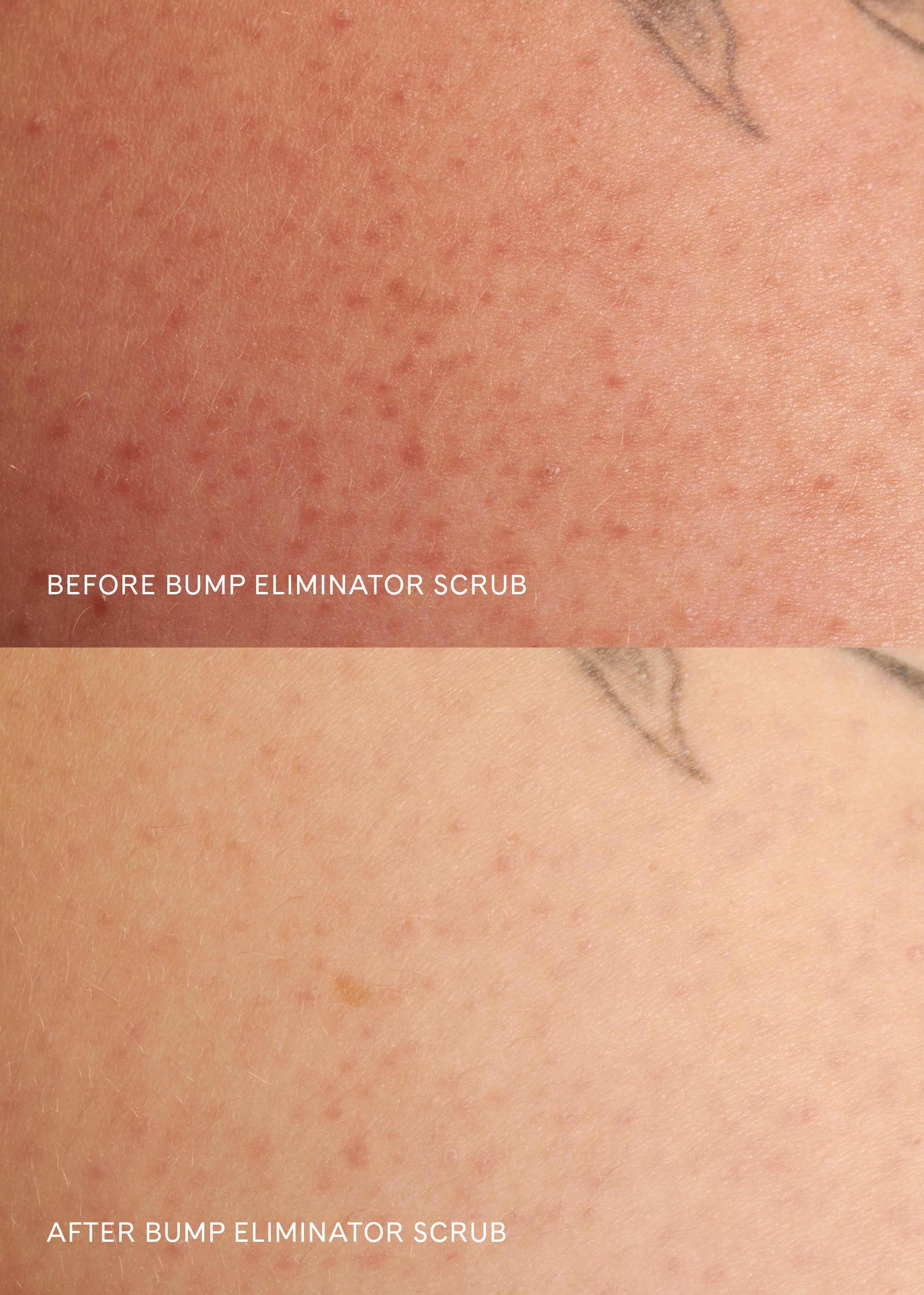 Bump Eliminator Scrub